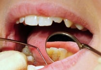 Hundreds of admissions for tooth extractions on children in Devon