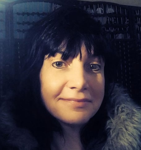 Leona Bull. See SWNS story SWTPhand. A woman feels like Edward Scissorhands after a freak wheelie bin accident and rare tumour left her with limited use of her hands. Leona Bull, 52, noticed a bump on her right hand and after it didnt go away she went to get it checked out by a doctor  who told her it was begin. After it continued to grow she pushed for it to be removed and thought nothing more of it until it grew back four years later. Doctors decided to remove the lump in August 2023 and after molecular genetic testing it came back as a rare soft tissue tumour called Dermatofibrosarcoma protuberans (DFSP).