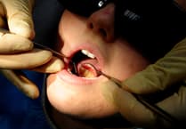 More than 100 hospital admissions in Teignbridge to remove children's rotten teeth