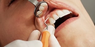 NHS dental scheme trial in Dawlish