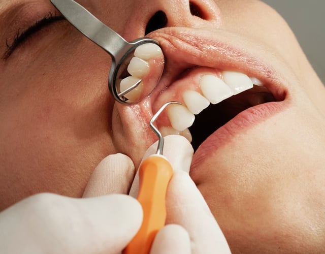 NHS dental scheme trial in Dawlish