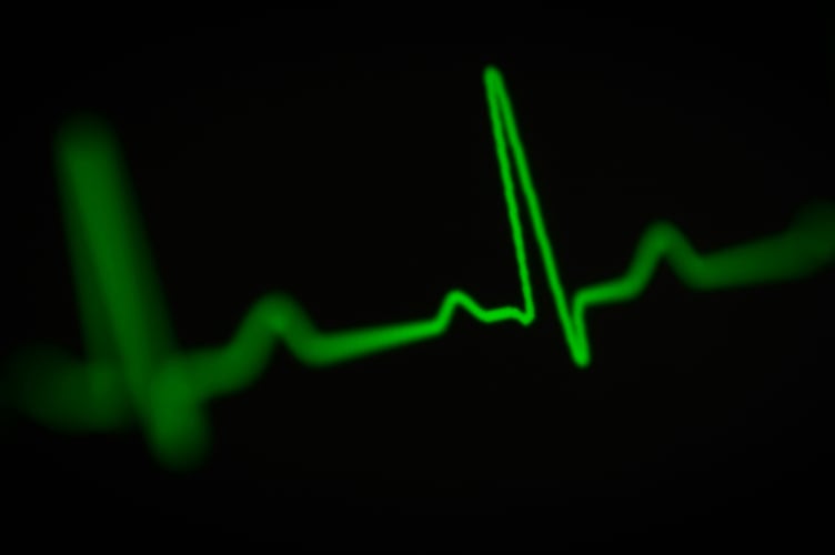 Heart monitor. Photo Unsplash