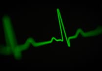 Controversial heart attack patient ‘trial’ decision deferred
