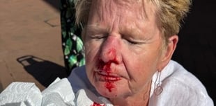 Former nurse injured in fall on ‘unfit’ Teignmouth street