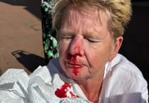 Former nurse injured in fall on ‘unfit’ Teignmouth street